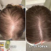 azenza Återväxt-Serum för att stoppa håravfall på 6 veckor